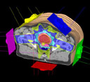 Segmented Chest CT Image